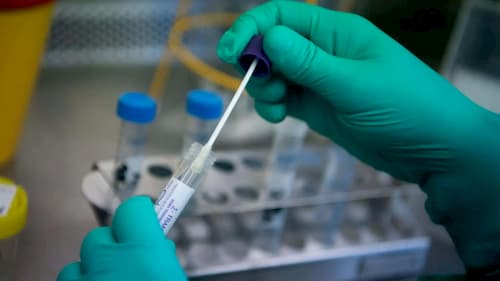 ifa test for coronavirus in a laboratory