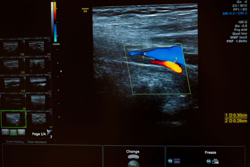 АО «Медицина» (клиника академика Ройтберга), помимо стандартных исследований, предлагает своим пациентам допплерографические исследования сосудов и ЗD/4D УЗИ.
